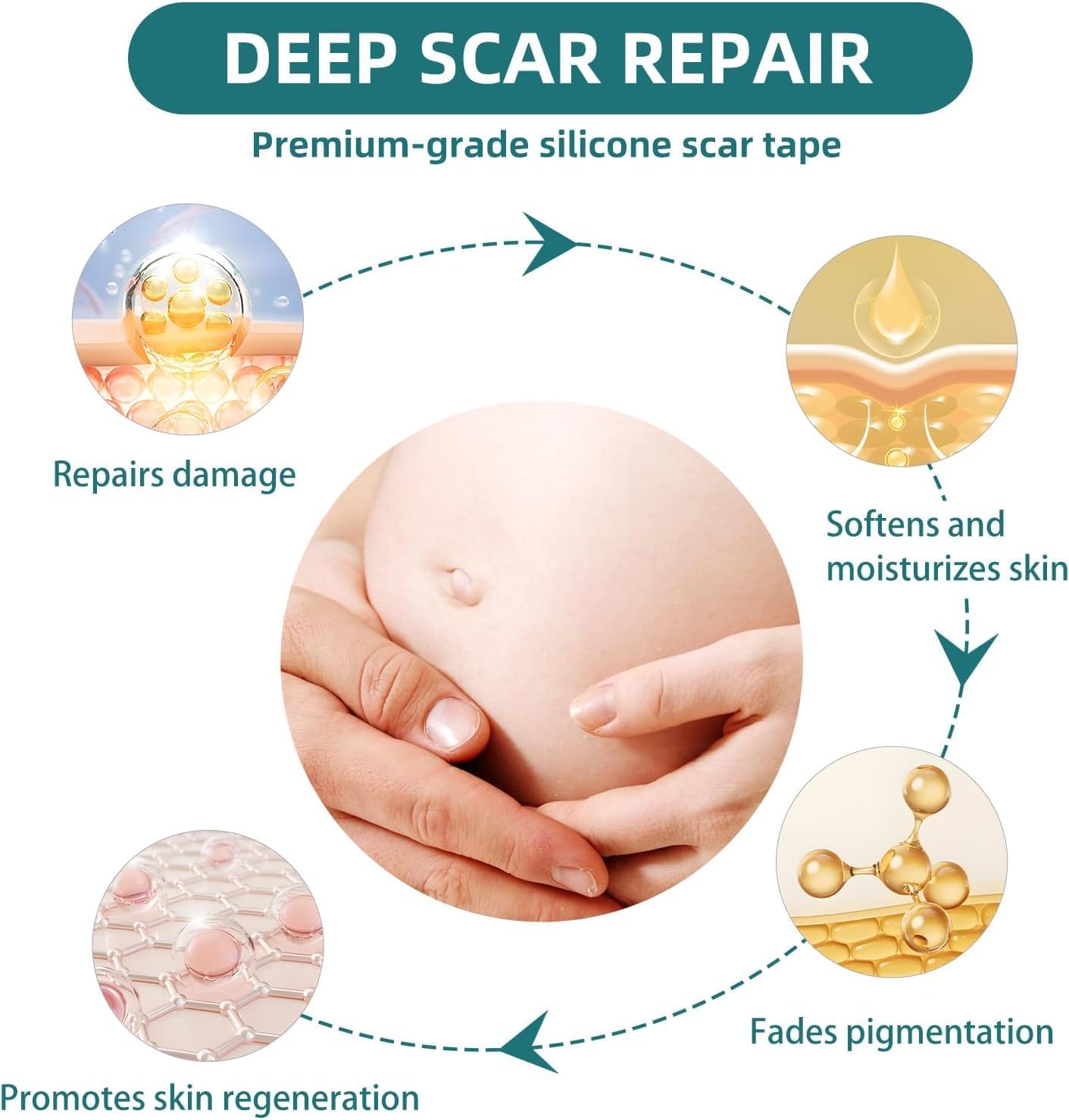 Silicone Scar Tape for Surgical Scars-3M