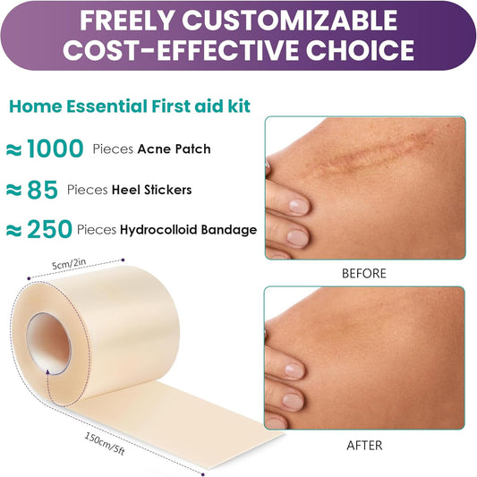 IBEELIV Medical-Grade Hydrocolloid Roll for Wound Care: 5cm × 1.5m Hydrocolloid Bandages, Cut-to-Size Self-Adhesive Patch Dressing, Waterproof