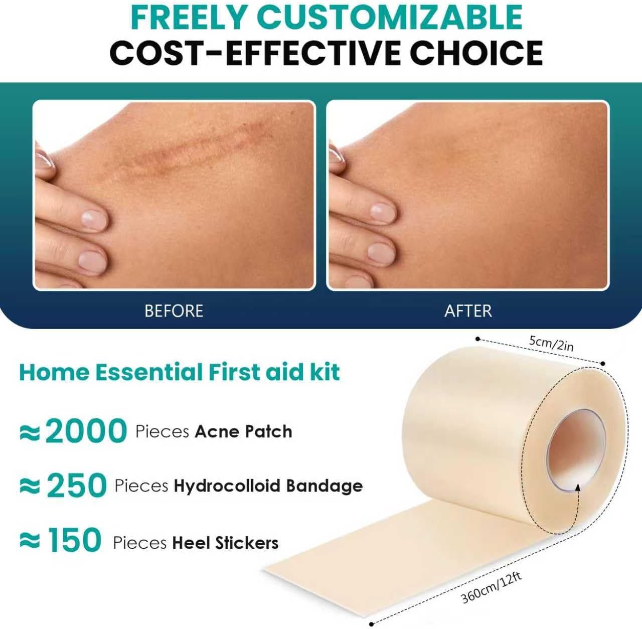 Medical-Grade Hydrocolloid Roll for Wound Care