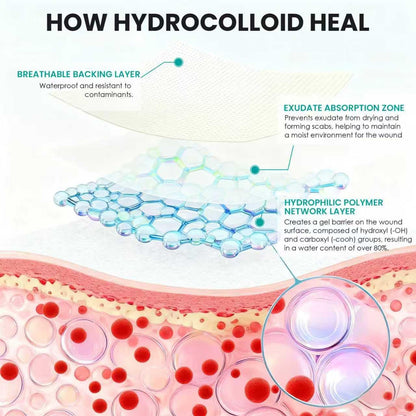 Medical-Grade Hydrocolloid Roll for Wound Care