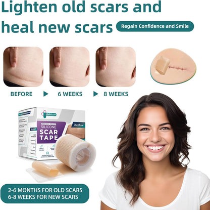 Silicone Scar Tape for Surgical Scars-3M