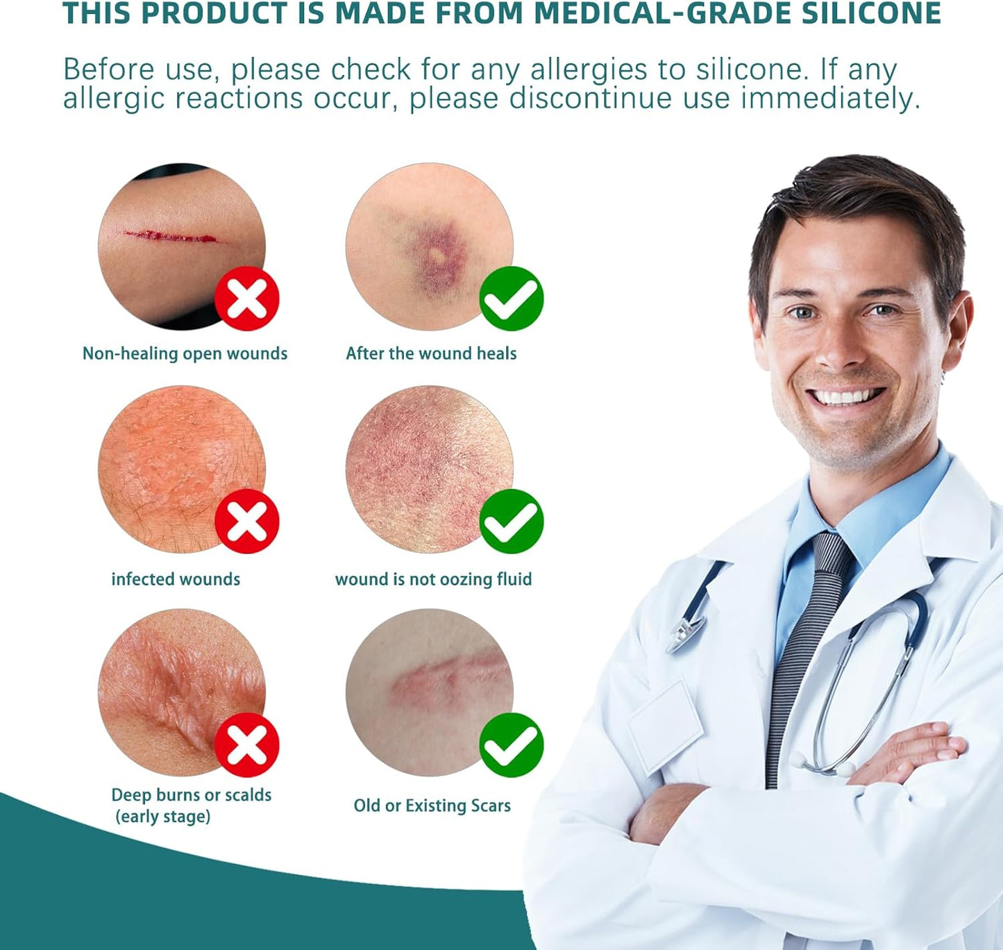 Silicone Scar Tape for Surgical Scars-1.5M