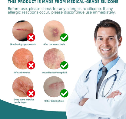 Silicone Scar Tape for Surgical Scars-1.5M