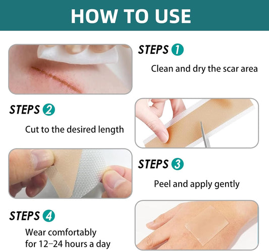 IBEELIV Silicone Scar Tape for Surgical Scars: Medical Grade Scar Gel Sheets for C-Section Tummy Tuck Recovery and Treatment (1.6'' x 60''Roll-1.5M)