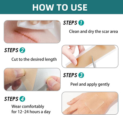 Silicone Scar Tape for Surgical Scars-3M